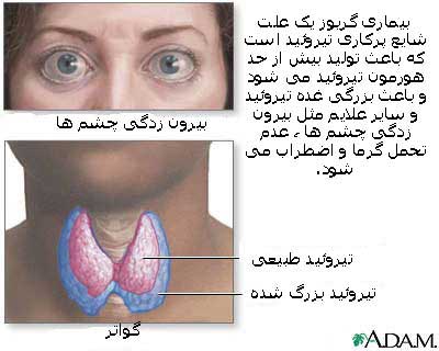 تیروئید تیروئید