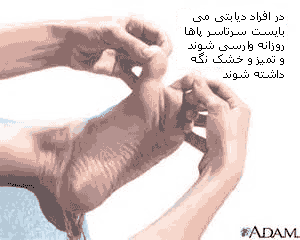 وارسی پاها در نوروپاتی وارسی پاها در نوروپاتی
